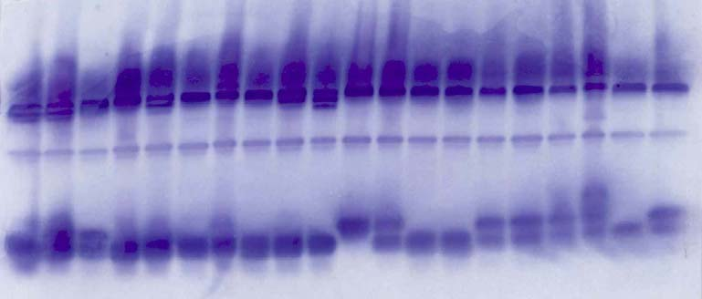 Introgrese vcentaurea phrygia agg. 6-PGDH AAT ADH DIA LAP PGM Obr. 10.