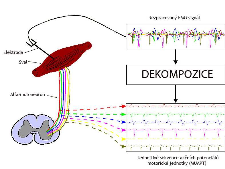 Obrázek10 Schéma průběhu dekompozice EMG signálu (dostupné z http://www.bu.edu/nmrc/t utorials/motor-units/) Kroky dekompozice EMG signálu 1. Zisk signálu 2. Segmentace (detekce MUPs) 3.