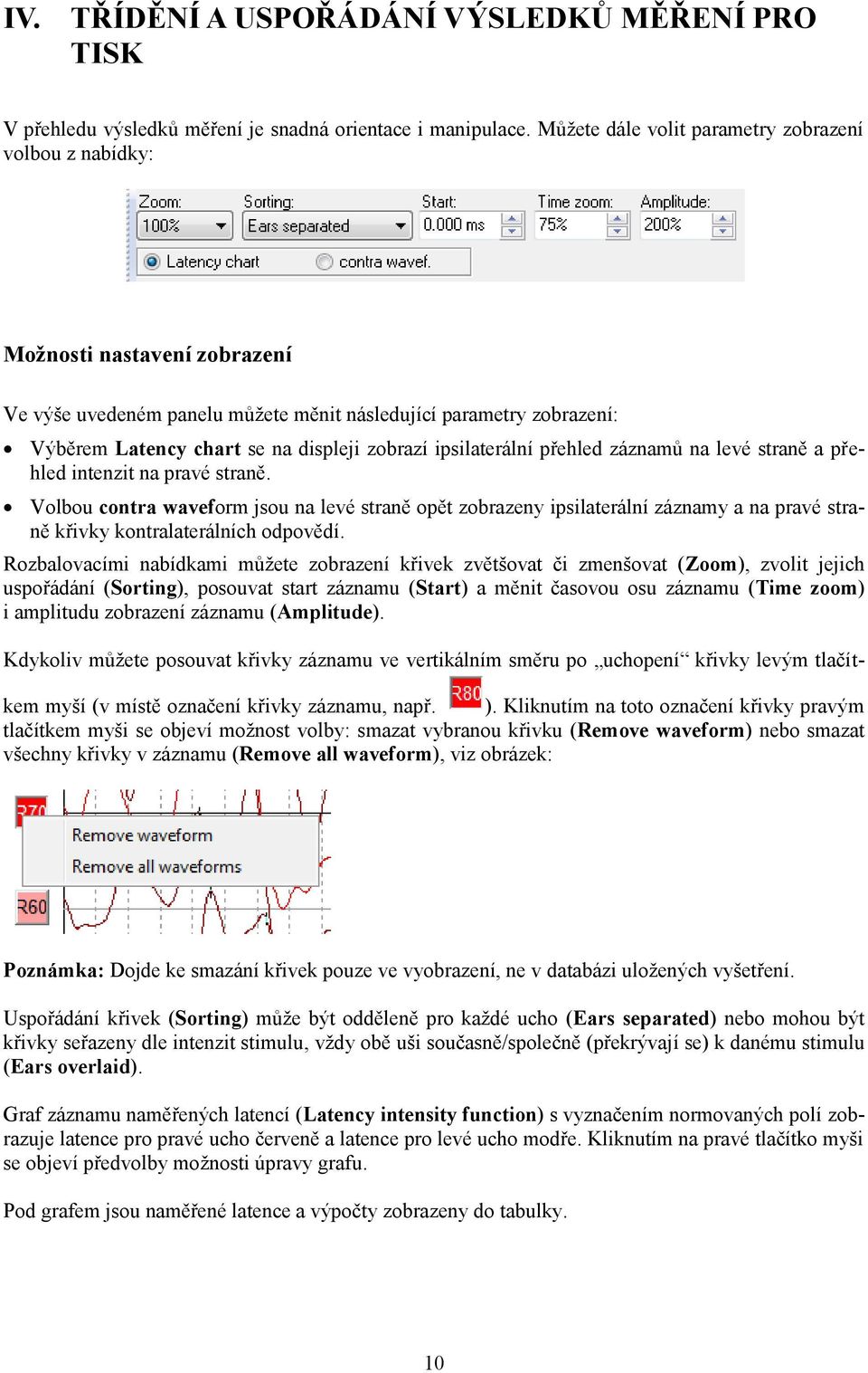 ipsilaterální přehled záznamů na levé straně a přehled intenzit na pravé straně.