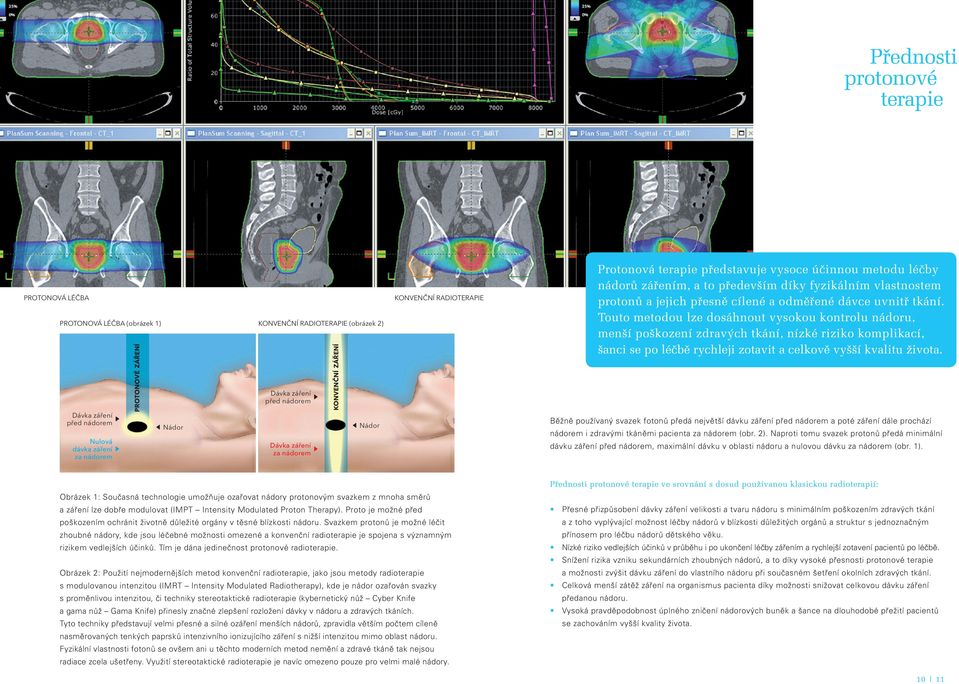protonů a jejich přesně cílené a odměřené dávce uvnitř tkání.