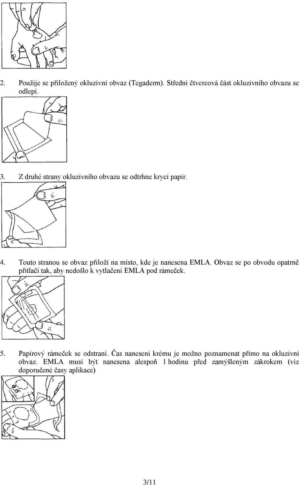 Obvaz se po obvodu opatrně přitlačí tak, aby nedošlo k vytlačení EMLA pod rámeček. 5. Papírový rámeček se odstraní.
