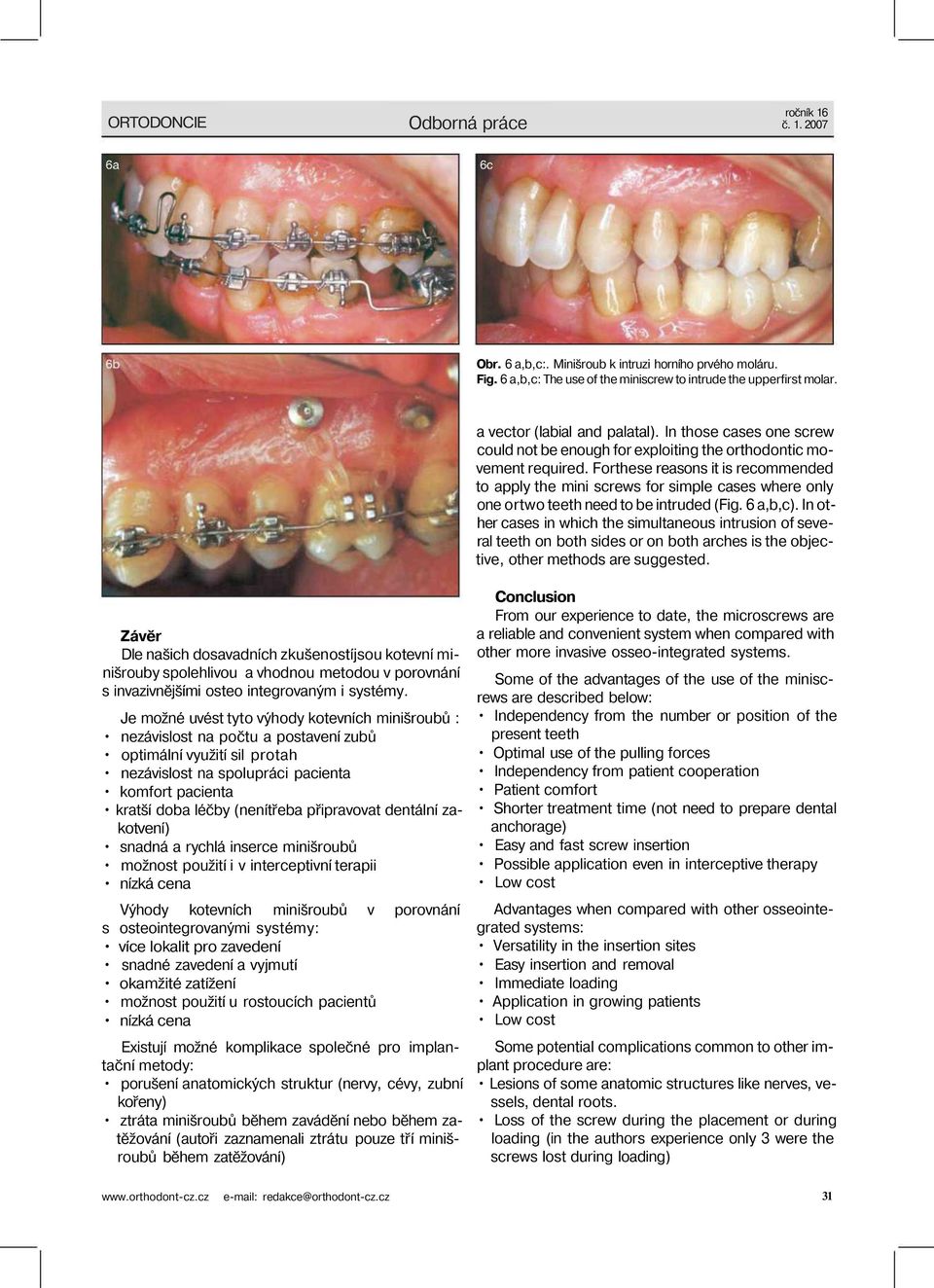 Forthese reasons it is recommended to apply the mini screws for simple cases where only one ortwo teeth need to be intruded (Fig. 6 a,b,c).