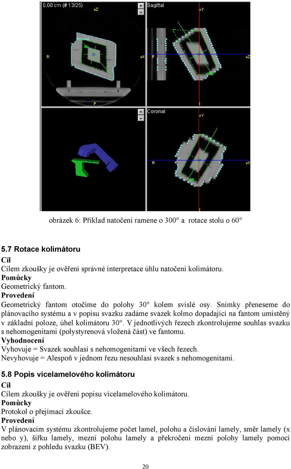 Snímky přeneseme do plánovacího systému a v popisu svazku zadáme svazek kolmo dopadající na fantom umístěný v základní poloze, úhel kolimátoru 30.
