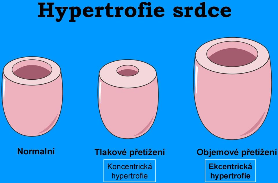 přetížení Koncentrická