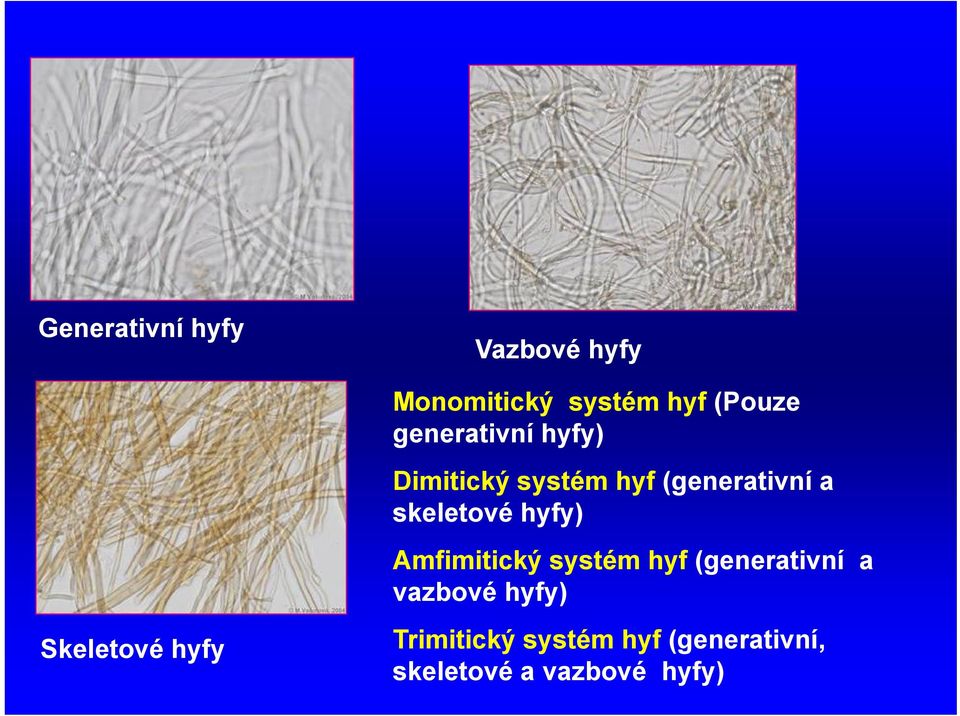 hyfy) Amfimitický systém hyf (generativní a vazbové hyfy)