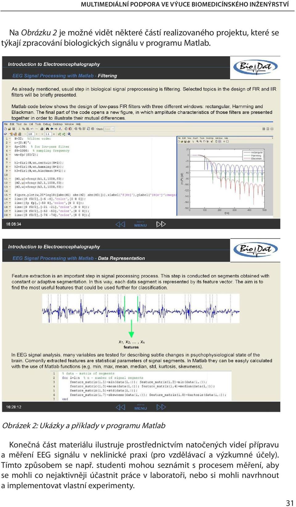 Obrázek 2: Ukázky a příklady v programu Matlab Konečná část materiálu ilustruje prostřednictvím natočených videí přípravu a měření EEG signálu v