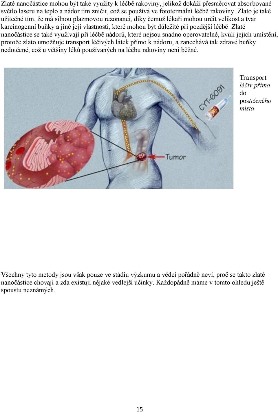 Zlaté nanočástice se také využívají při léčbě nádorů, které nejsou snadno operovatelné, kvůli jejich umístění, protože zlato umožňuje transport léčivých látek přímo k nádoru, a zanechává tak zdravé