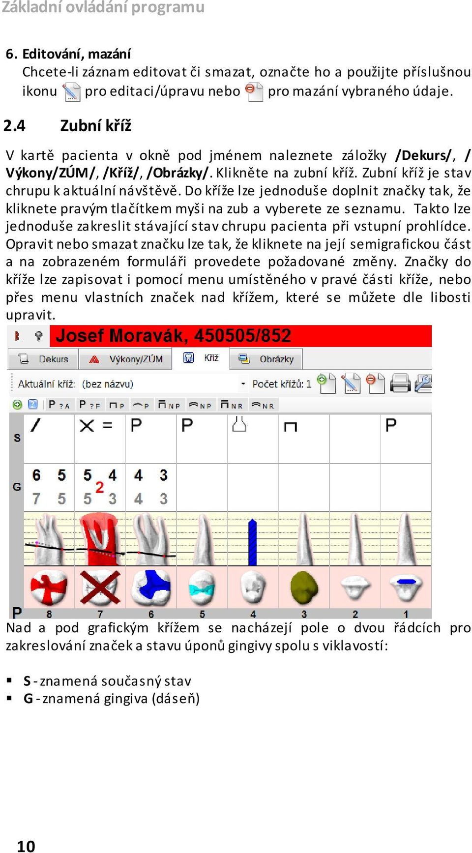 Do kříže lze jednoduše doplnit značky tak, že kliknete pravým tlačítkem myši na zub a vyberete ze seznamu. Takto lze jednoduše zakreslit stávající stav chrupu pacienta při vstupní prohlídce.