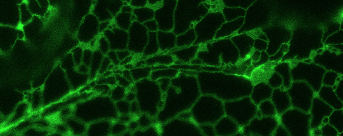 Endoplasmatické retikulum ER vizualizované pomocí GFP - syntéza proteinů pro endomembránové kompartmenty, membrány a sekreci -