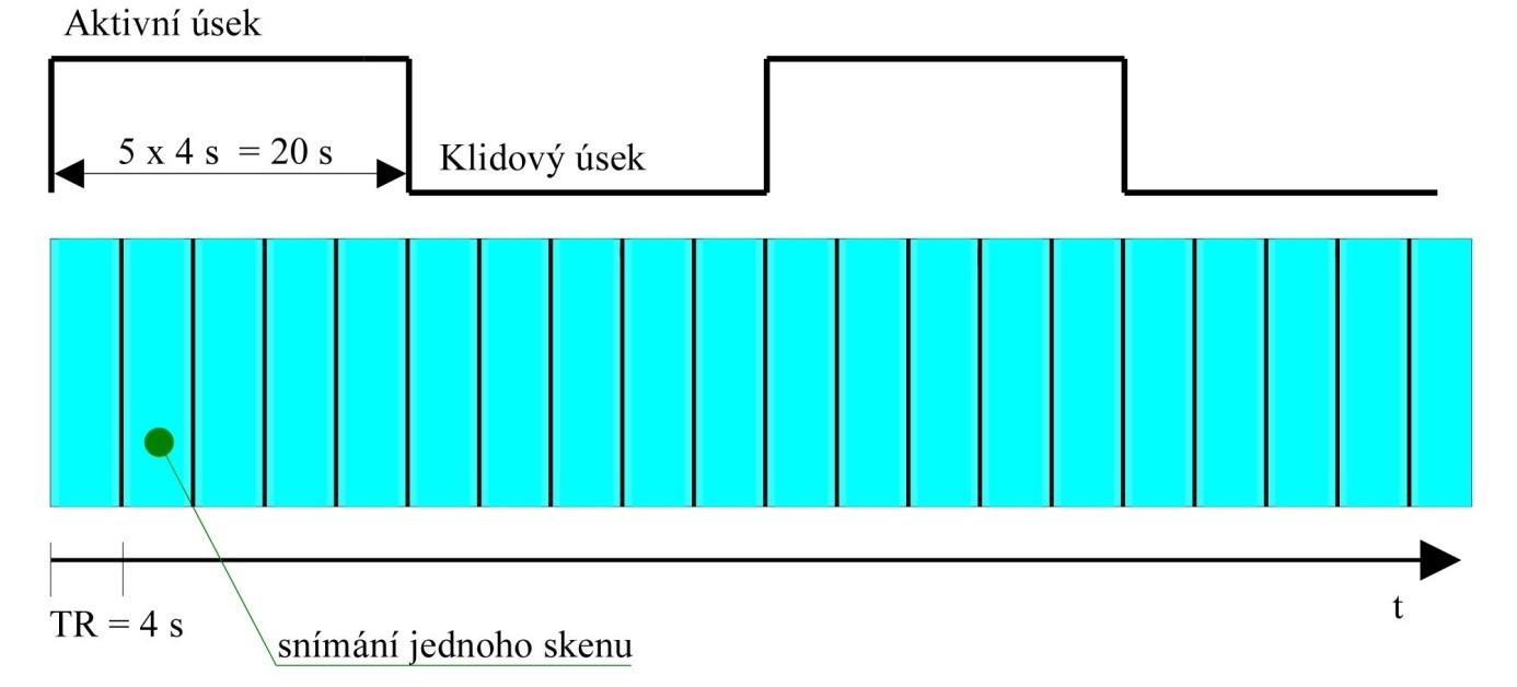 Obrázek 2.4 Schéma blokového designu (TR = doba snímání jednoho fmri skenu) [16] překryvu jejich hemodynamických odezev (obrázek 2.3).