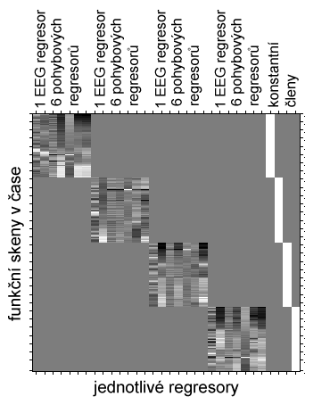 6.3 Vliv šumových regresorů Při předchozí analýze je pohyb nevysvětlená variabilita v datech.