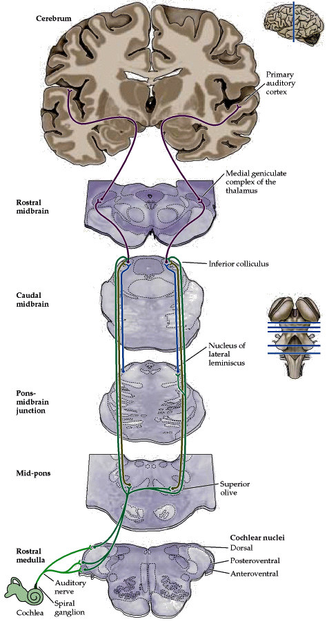 Nucleus spiralis cochleae Nucleus cochlearis ventralis I for a e o i te zitě Časová prodleva pro s ěrové sl še í Nucleur cochlearis dorsalis I for a e o výš e Olivár í jádra A alýza s ěru Modula e