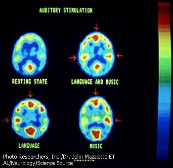 NEUROTRANSMISE Snímky mozku pořízené pomocí emisního protonového tomografu.