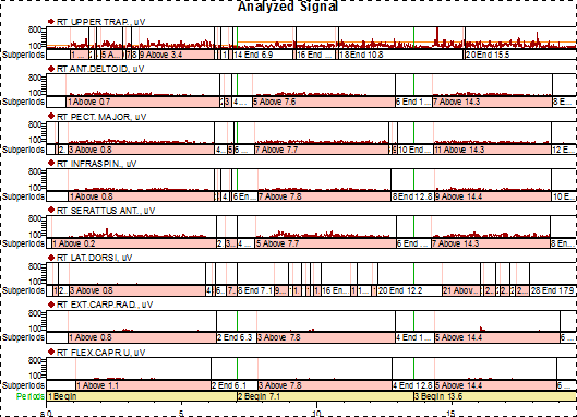 Př. Timing úchopu válce 9 8 7 6 5 4 3 2 1 0 Firing Order pořadí zapojení 1.pokus 2.pokus 3.pokus ONSET OFFSET Periods horní trap. deltoide us pect maj infraspin atus serratu lat.dor ext.car flex.