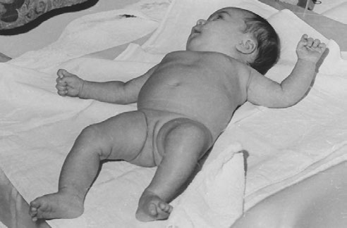 50 / vývojová psychologie plod v koncepčním věku 3 měsíce novorozenec kojenec 5 měsíců kojenec 9 měsíců Obr.