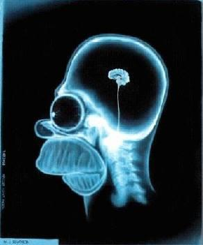 Mozeček = Cerebellum 10 % hmotnosti celého mozku