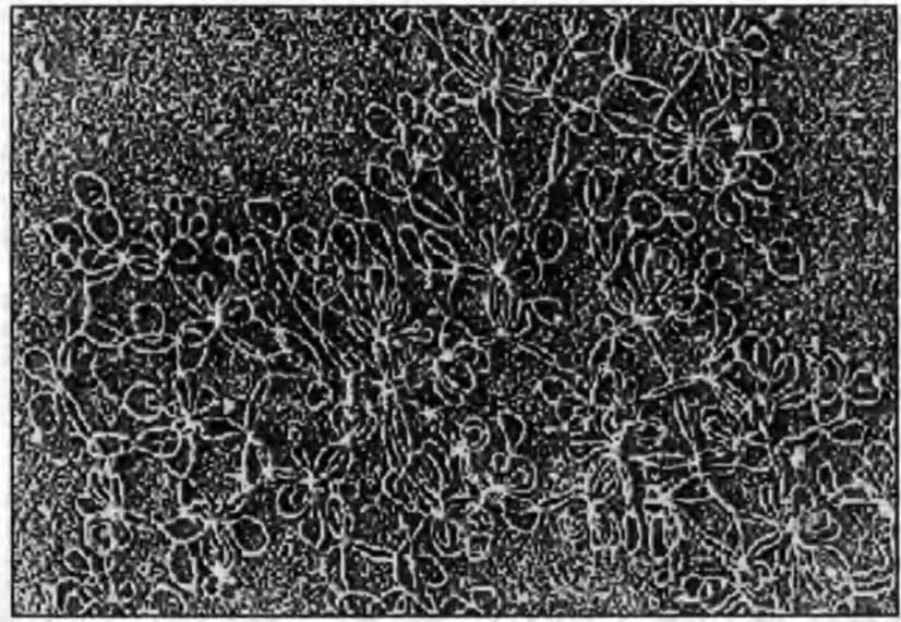 semiautonomní organely kinetoplasty odvozené od mitochondrií v protozoích (například Trypanozomy, Leishmanie, ), odlišná morfologie a lokalizace obsahují asi 7% buněčné DNA kolokalizace s bazálními