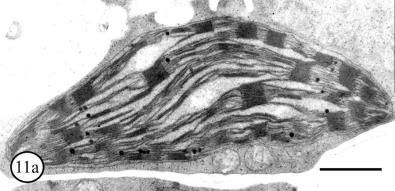 semiautonomní organely plastidy muroplast elaioplast rhodoplast chromoplast protoplastid gerontoplasty etioplast přeměna etioplastu na chloroplast
