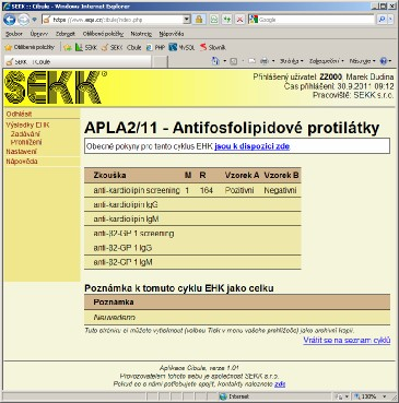 Cibule (webová aplikace pro sběr dat) Stručný návod pro zadávání výsledků (tj. jejich odesílání do SEKKu) pomocí webové aplikace Cibule. 1. 2. Aplikaci Cibule spustíte tak, že na stránce www.sekk.