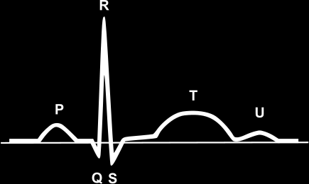 Elektrokardiografie a elektrokardiogram Elektrokardiografie (EKG) je základní vyšetřovací metoda v kardiologii. Jejím principem je snímání elektrické srdeční aktivity.