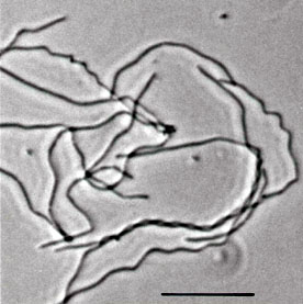 Methanosarcina mazei Methanosarcina barkeri