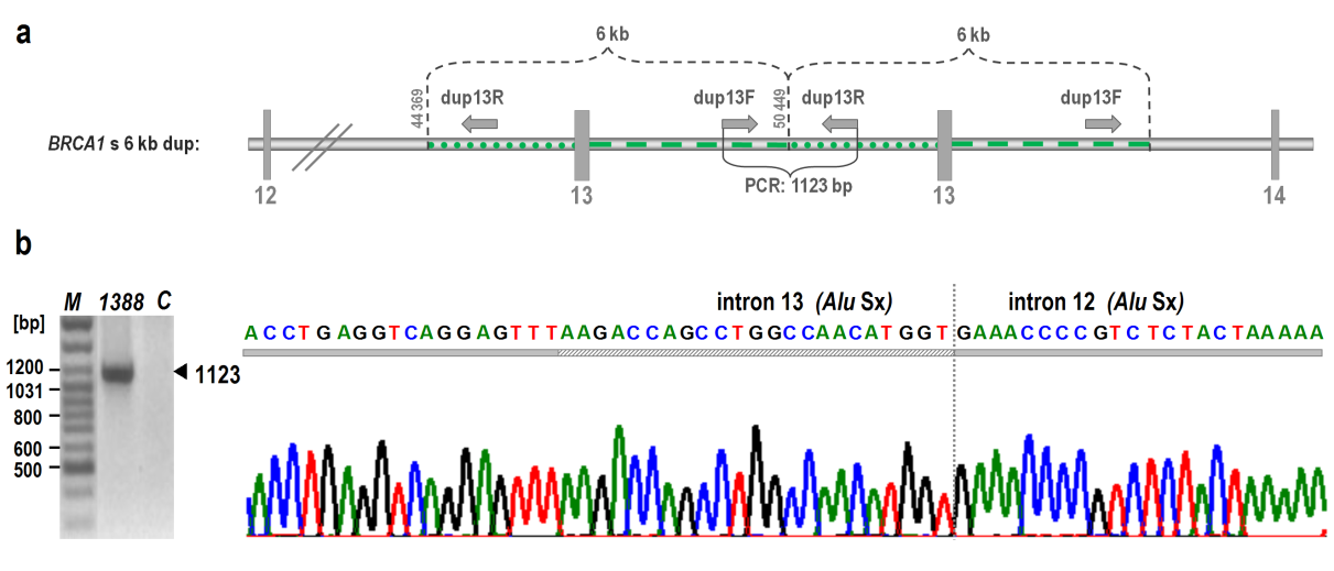 U jedné pacientky No 1388 s karcinomem prsu z HBOC rodiny byla MLPA analýzou detekována duplikace exonu 13 (Obr. 10).