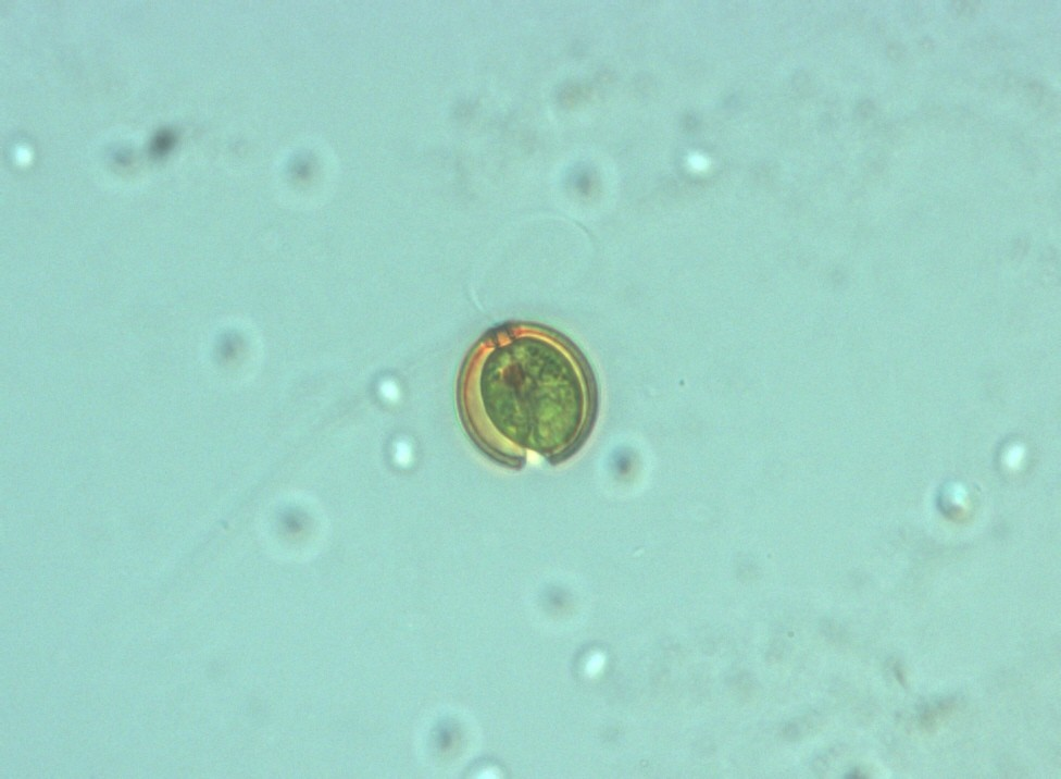 Odd.: Euglenophyta Třída: Euglenophyceae Řád: Euglenales