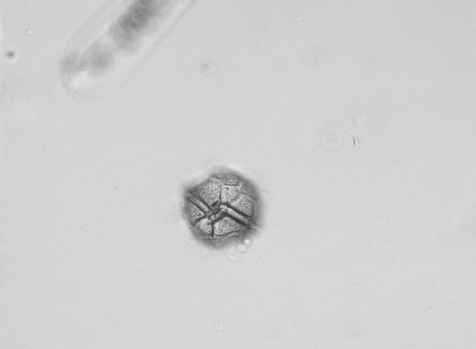 Odd.: Dinophyta Třída: Dinophyceae Řád: Peridiniales podélná