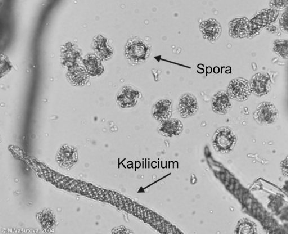 Typy sporokarpů Kapilicium a spory AETHALIUM Fuligo septica, Slizovka