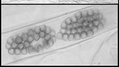 Spongospora subterranea Prašná strupovitost brambor Polymyxa betae