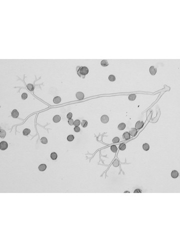 Pseudoperonospora cubensis sporangia Pseudoperonospora