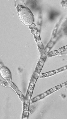 Oddělení: HYPHOCHYTRIOMYCOTA Malá skupina, morfologicky podobná chytridiomycetům, ale biochemicky a ultrastrukturálně spíš oomycetům.