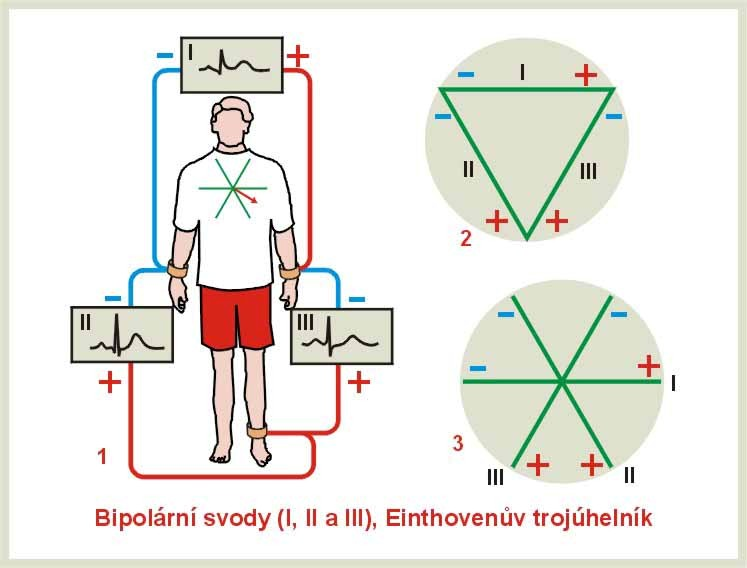- 24 - Obrázek 13 Bipolární svody (I, II, III) podle Einthovena a Einthovenův trojúhelník b) končetinové unipolární.