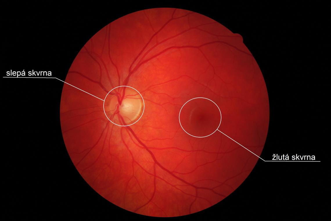 Obrázek 9: Snímek sítnice pořízený fundus kamerou s vyznačenou slepou a žlutou skvrnou [11].