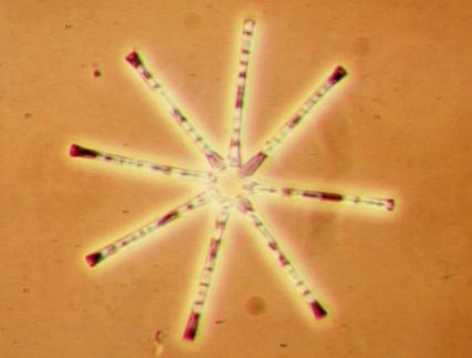 3 HLAVNÍ MODELOVÉ SYSTÉMY HOSTITEL PARAZIT 3.1 Rozsivka Asterionella formosa + chytridie Zygorhizidium planktonicum 3.1.1 Charakteristika, ekologie a životní cykly 3.1.1.1 Asterionella formosa Asterionella formosa patří do říše Chromista, oddělení Heterokontophyta, třída Bacillariophyceae (Urban & Kalina 1980).