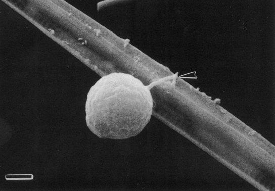 3.1.1.2 Zygorhizidium planktonicum Patří do říše Fungi, oddělení Chytridiomycota (často označované jako chytridie), třída Chytridiomycetes, řád Chytridiales (Urban & Kalina 1980). Z. planktonicum je obligátní parazit vyskytující se v mořském i sladkovodním prostředí a vlhké půdě (Doggett & Porter 1995; Ibelings et al.