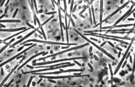 3.3.1.5 Caullerya mesnili Caullerya mesnili je parazitický prvok řazený do třídy Ichthyosporea (Lohr et al. 2010).