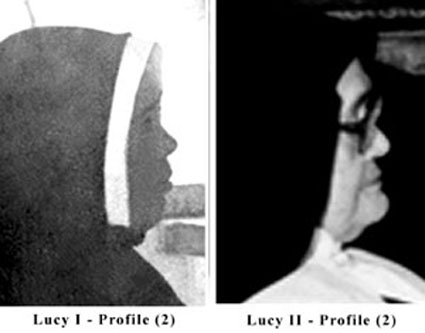 Další charakteristický rys Lucie jako dítěte, který můžeme vidět na jejích fotografiích až do jejích 40 let, je vyčnívající sval uprostřed brady, dost zřetelný, aby dole (na spodní straně) vytvořil