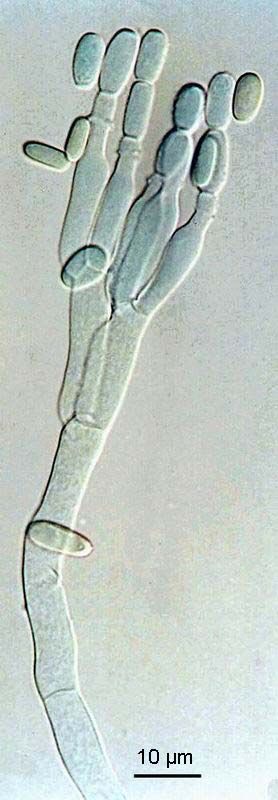 Penicillium digitatum mikroznaky,