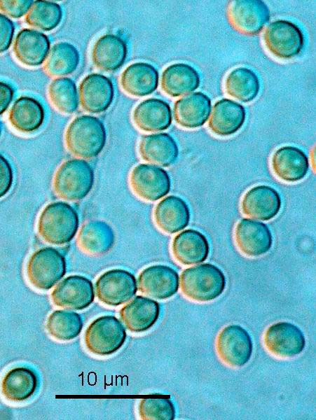 Penicillium expansum mikroznaky Konidie, DIC,