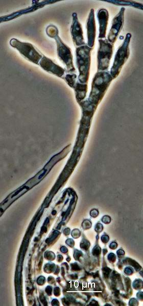 Penicillium arenicola mikroznaky,