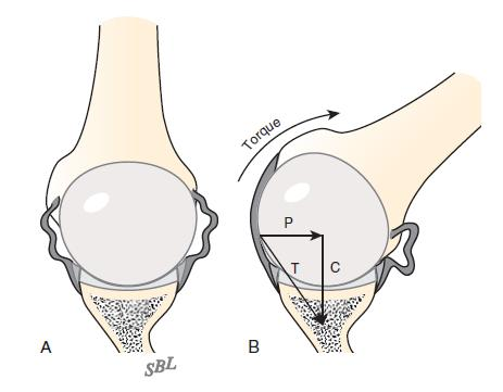 s. 2122), (Dylevský, 2009, s. 108). Mezi ligamenta glenohumeralia patří ligamentum glenohumerale superior (dále jen SGHL), mediale (MGHL) a inferior (IGHL).