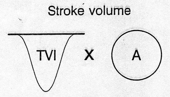 CO = SV x HR (Harvey W 1628) SV (ml) = VTI