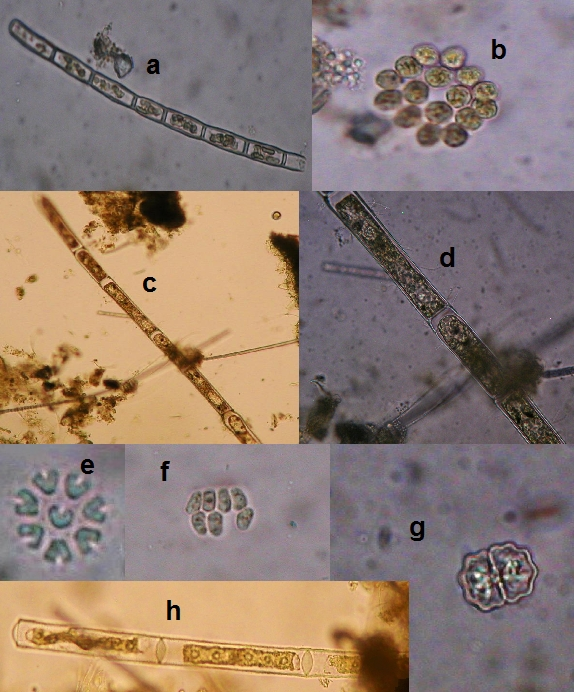 Obr.18 a - Tribonema sp. - zv. 300x, b - Gonium pectorale zv. 150x, c - Oedogonium sp. - zv. 75x, d Oedogonium sp. - zv. 300x, e - Pediastrum tetras - zv.