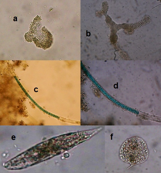 PŘÍLOHY Fotografie vybraných zástupců sinic a řas nalezených na lokalitě mrtvého ramena řeky Bečvy v PR Škrabalka Obr.15 a - Microcystis sp. - zv.