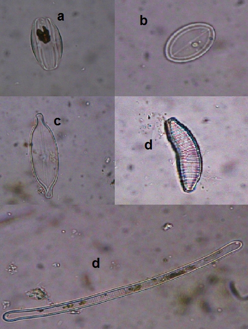 Obr.16 a - Amphora sp. - zv. 300x, b - Cocconeis sp. - zv. 300x, c - Craticula ambigua - zv.