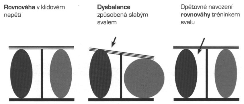 Prevence vadného držení spočívá ve správné pohybové výchově již od kojeneckého věku a nejlepší formou je pravidelné cvičení a sportování.