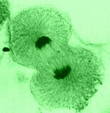 Telofáze a cytokineze Telofáze opětná dekondenzace chromosomů začíná se tvořit jaderný obal ohraničující chromosomy Cytokineze začíná ve