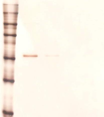 Turbidity (AU) Absorbance * 10 2 [AU] 0,5 0,4 0,3 Control Beads with captured bacteria Medium after immunoextraction 1,4 1,2 1,0 0,8 + 0,2 0,6 0,1 0,4 0,2 Eluate Beads A 0 0 4 8 12 Cultivation time