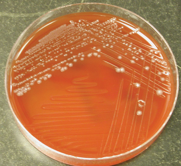 Clostridium tetani Normální flóra v GIT koní Pohybuje se pomocí peritricheálních